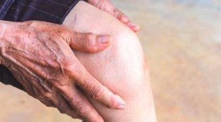 Knee osteoarthritis