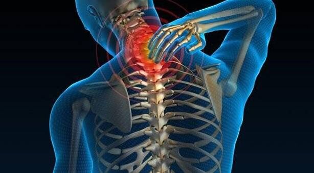 Spinal condyle