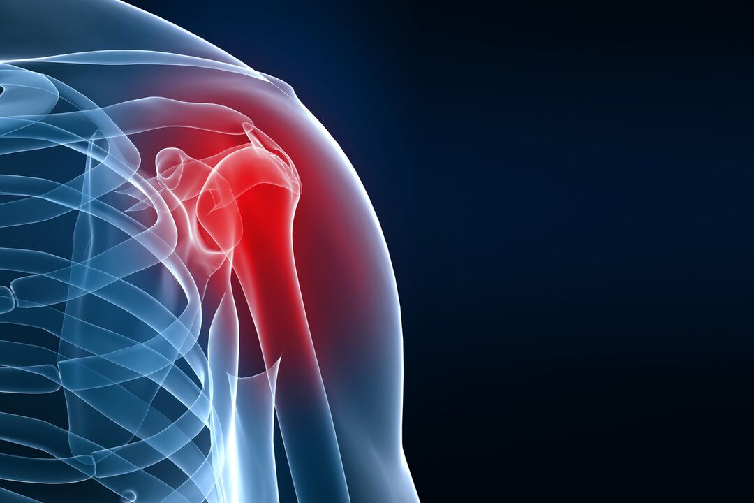 Shoulder joint disease